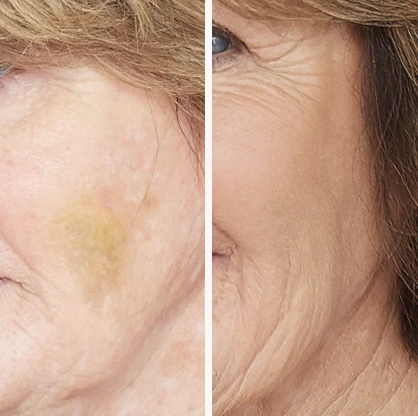 Corrective Colors - Image 3