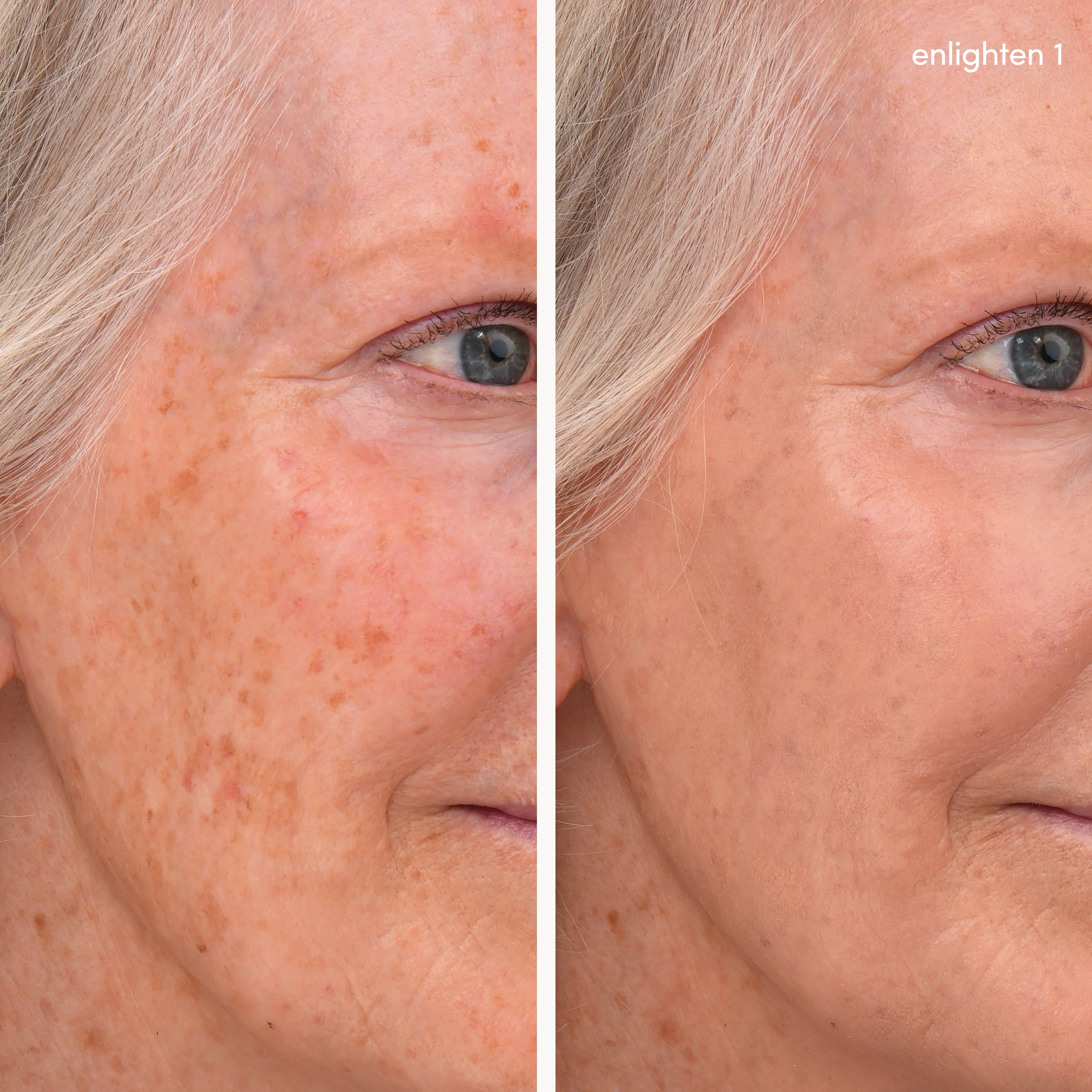 Enlighten Concealer™ - Image 8